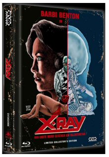 X-Ray - Der erste Mord geschah am Valentinstag (Limited Mediabook, Blu-ray+DVD, Cover B) (1982) [FSK 18] [Blu-ray] 